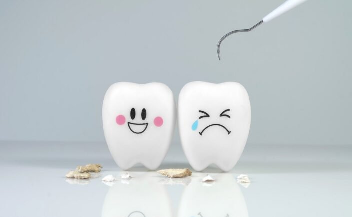 Remoção de tártaro nos dentes